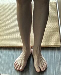 皆さんこの方は何歳と思いますか？

左足が朝からむくみ痺れてたと言われてたお客様から朝起きてもむくみなく夕方もむくみがなくなり感激の感想頂きました。只今69歳❗️綺麗な足ですよね。^_^