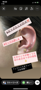 左首のこりが強いお客様！やっぱり耳ツボをすると左耳の赤さで、こりがわかりやすい。耳ツボ貼る事で、ポカポカと満足スッキリと喜んで頂きました