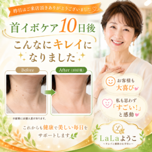 10日前ご来店時にとても首イボを気になってると言われたお客様
本日リンパ施術中に首イボ無くなってたので、びっくり‼️
食習慣アドバイスを実践された結果　お客様とても喜んでいてよかったです💓